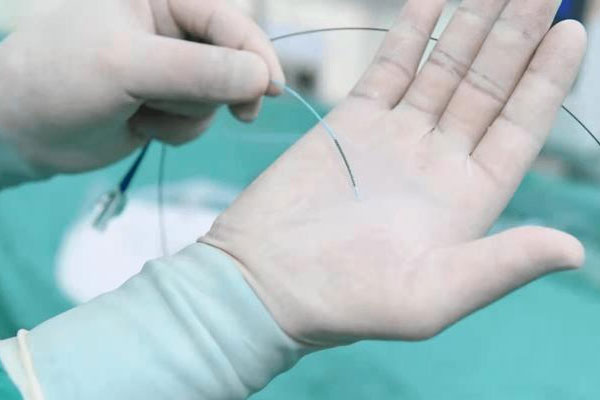 PTCA冠脈球囊導管激光打孔工藝 PTCA冠脈球囊導管激光打孔工藝